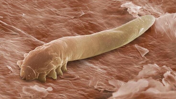 生活在人类皮肤下的蠕虫