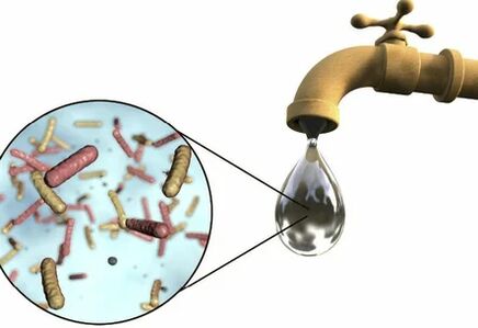从起重机中滴水的寄生虫