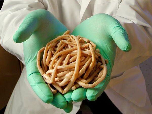 什么是危险的寄生虫
