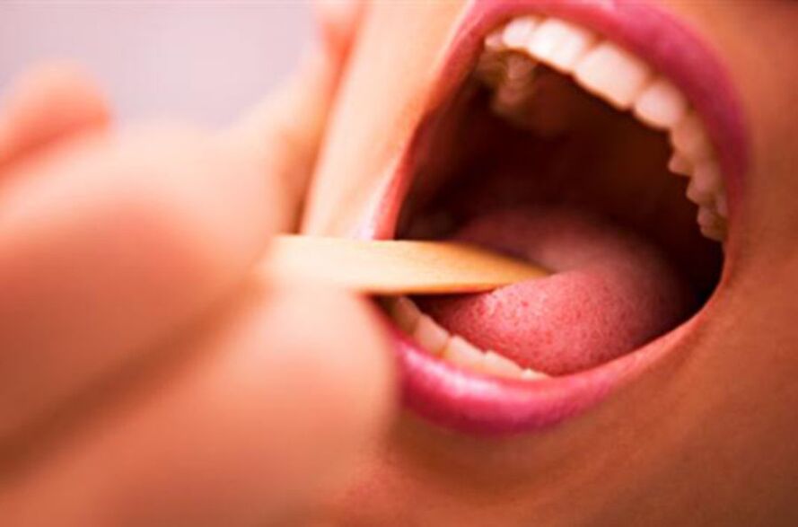 人类口腔中的寄生虫类型