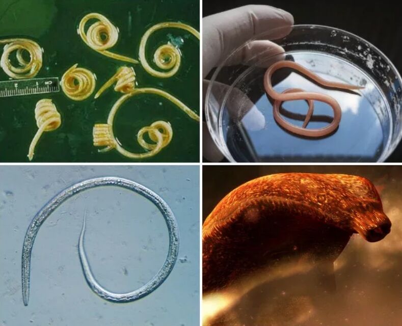 人体中的蠕虫类型
